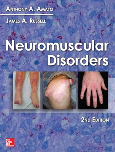 Neuromuscular Disorders von McGraw-Hill Education